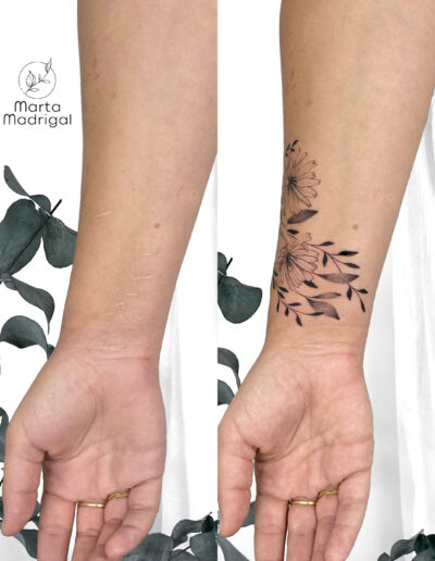Tatouage cicatrice automutilation