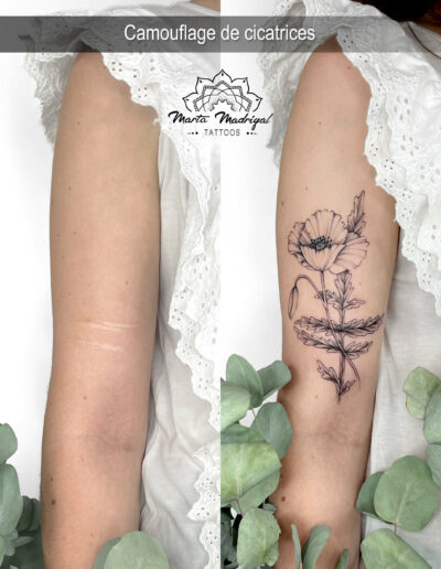 Tatouage cicatrice automutilation femme