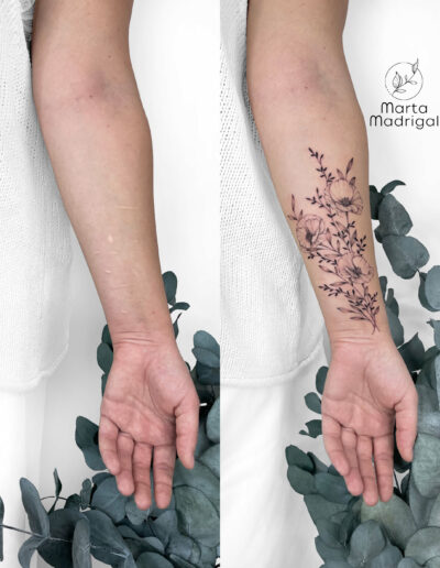 Tatouage cicatrices automutilation