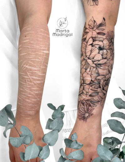 Tatouage cicatrices automutilation bras femme