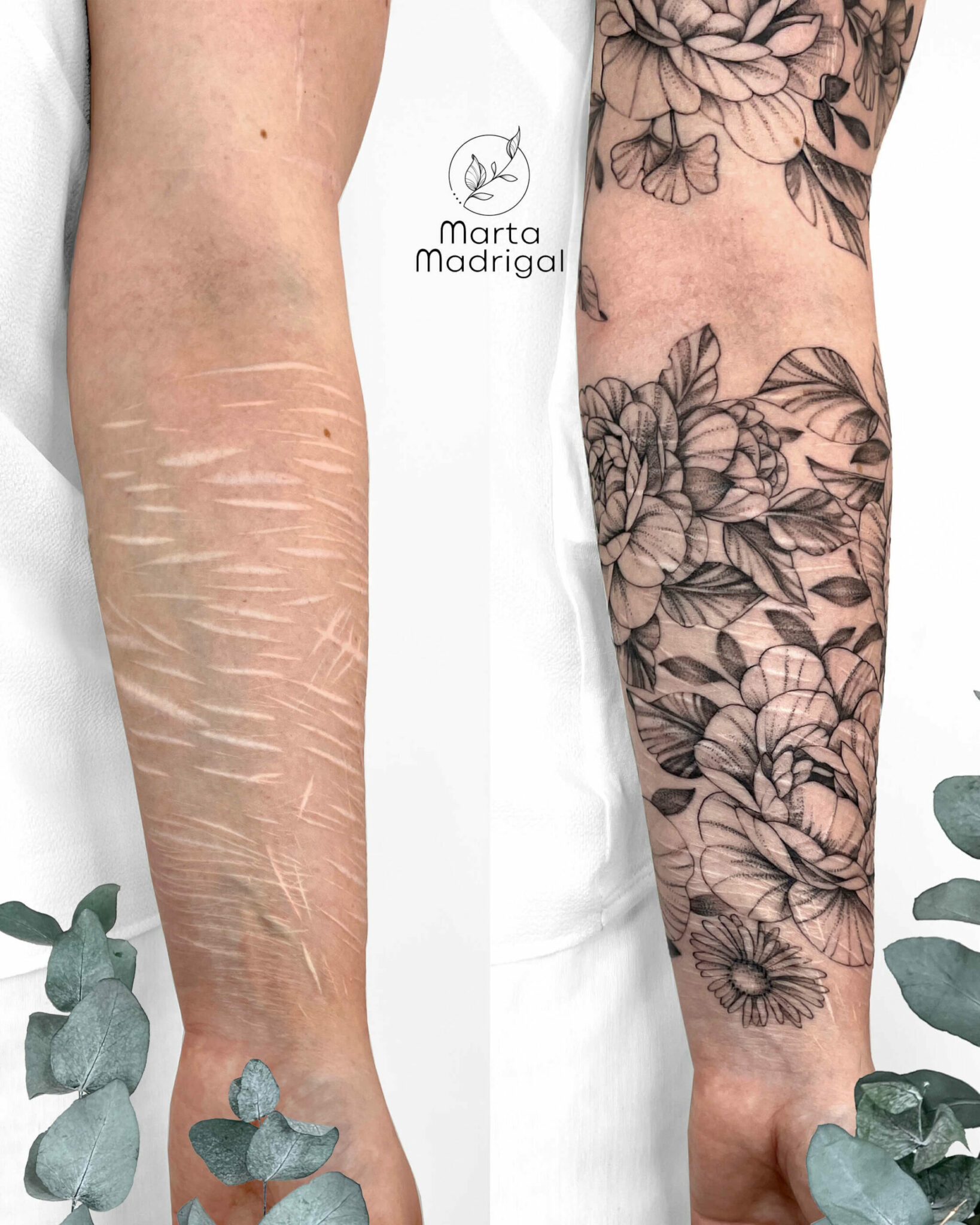 Tatouage cicatrices automutilation femme