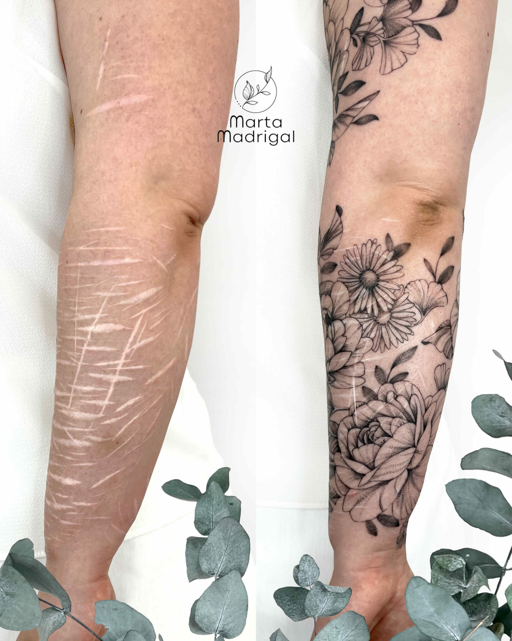 Tatouage cicatrices automutilation