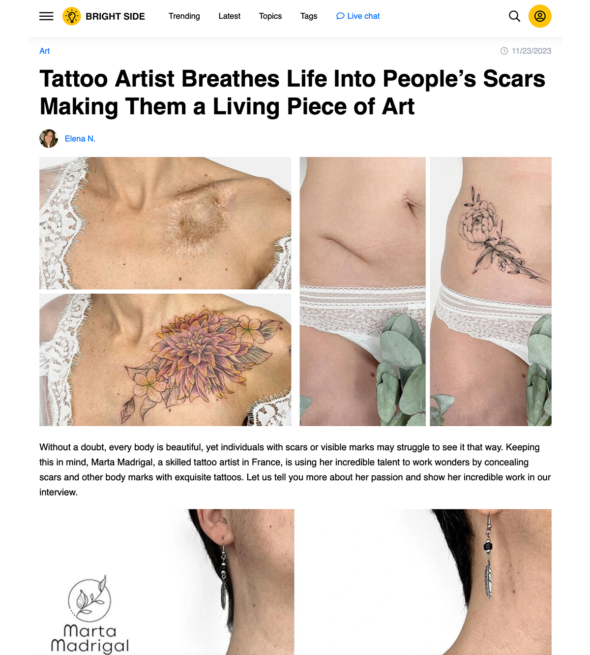 Capture de l’article Bright Side sur les tatouages qui transforment les cicatrices
