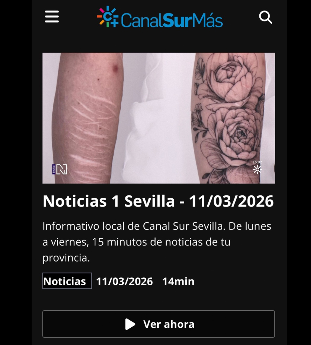 Capture du reportage télévisé de Canal Sur sur l’exposition de tatouage réparateur