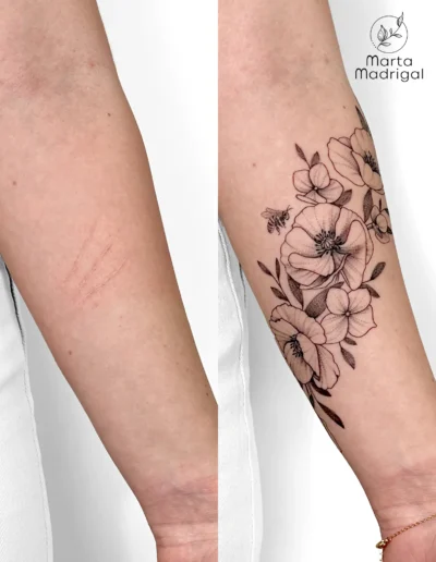 Tatouage coquelicots, hortensia et abeille en couverture de cicatrice sur l'avant-bras, a Toulouse
