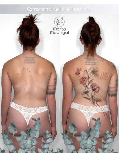 Tatouage de coquelicots et marguerites avec papillon sur le dos, correction visuelle de scoliose à Toulouse