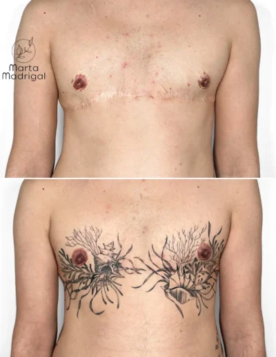 Tatouage corail et coquillages en couverture de cicatrice de mastectomie sur le torse, a Toulouse