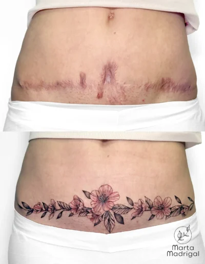 Tatouage fleurs de cerisier en couverture de cicatrice de cesarienne, a Toulouse
