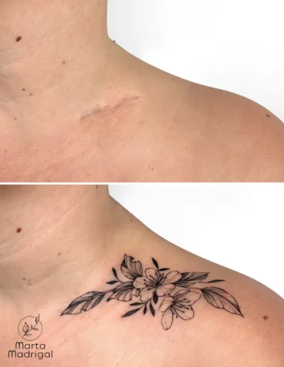 Tatouage fleurs de cerisier en couverture de cicatrice sur la clavicule, a Toulouse