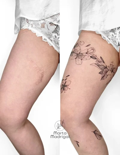 Tatouage fleurs de cerisier en couverture de cicatrice sur la cuisse, a Toulouse