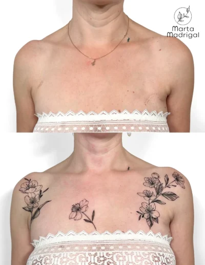 Tatouage fleurs de cerisier en couverture de cicatrices sur les deux clavicules, a Toulouse
