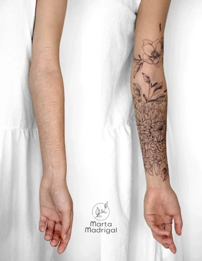 Tatouage floral (chrysanthemes) en couverture de cicatrice sur l'avant-bras, a Toulouse