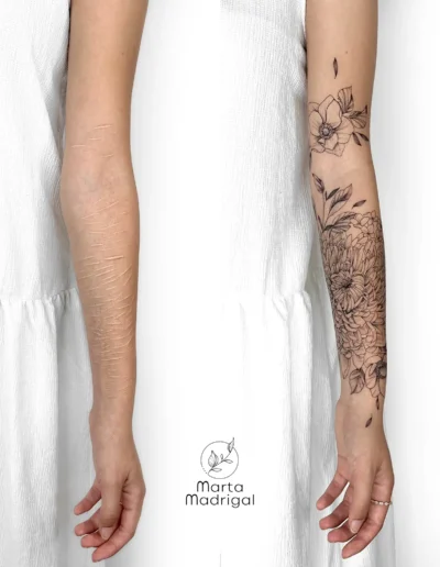 Tatouage floral (cosmos) en couverture de cicatrice sur l'avant-bras, a Toulouse