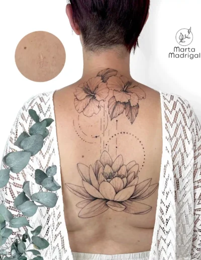 Tatouage hibiscus et fleur de lotus en couverture de cicatrice sur la nuque et le dos, a Toulouse