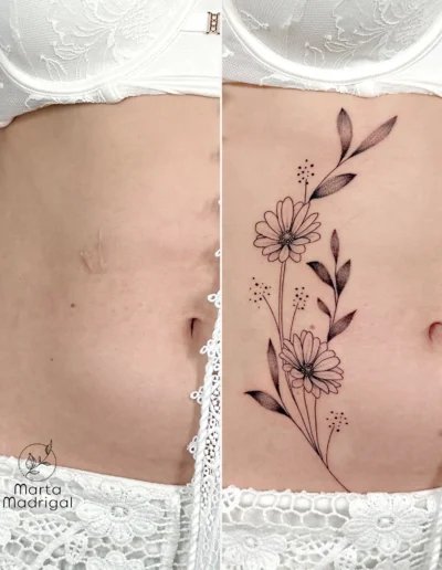 Tatouage marguerites en couverture de cicatrice sur le ventre, a Toulouse