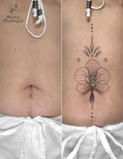 Tatouage orchidee en couverture de cicatrice pres du nombril, a Toulouse