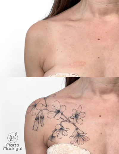Tatouage fleur d'oxalis en couverture de cicatrice sur la clavicule, a Toulouse