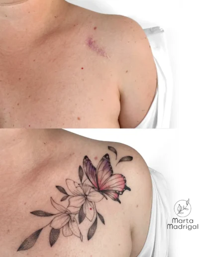 Tatouage papillon et fleurs de jasmin en couverture de cicatrice sur la poitrine, realise a Toulouse