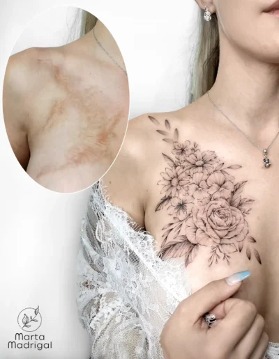 Tatouage floral (roses, fleurs de cerisier, marguerites et violettes) en couverture de brulure sur la clavicule, a Toulouse